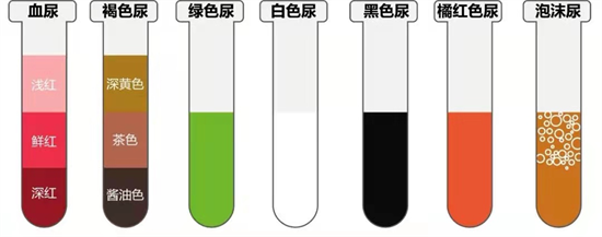 蛋白低血红蛋白正常是什么原因_血红蛋白偏低的原因及危害有哪些_原因蛋白偏低危害血红有问题吗