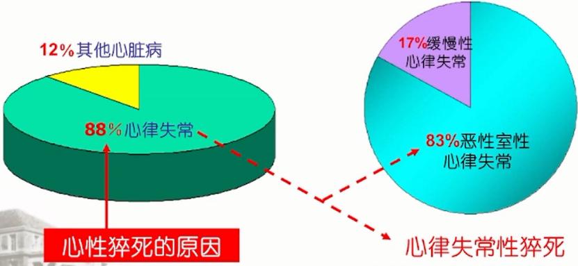 心律失常性猝死常发生,如何准确识别心电危急值?