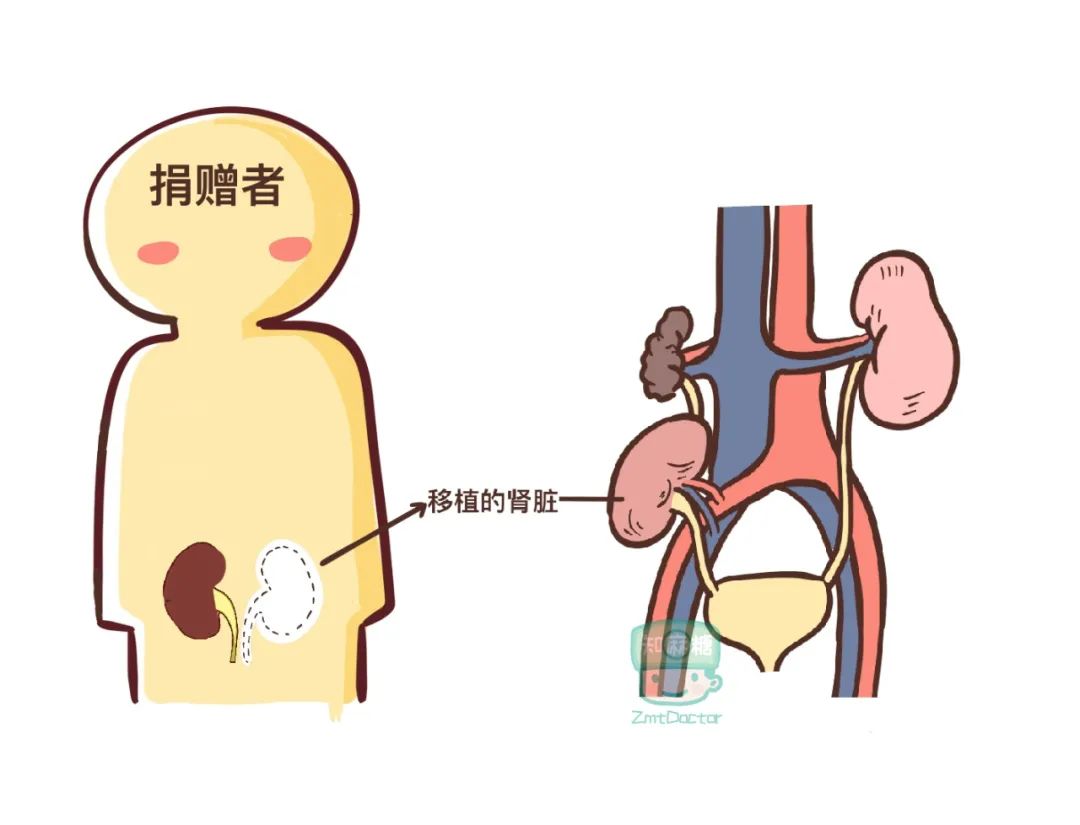 肾脏手抄报图片