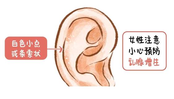 除此以外还有一个地方与妇科息息相关就是耳三角区耳三角区对应的是