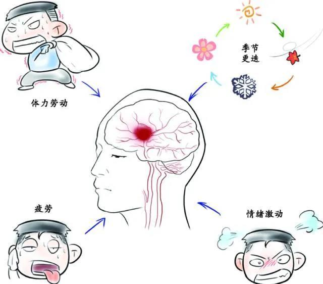 脑出血动画演示图片