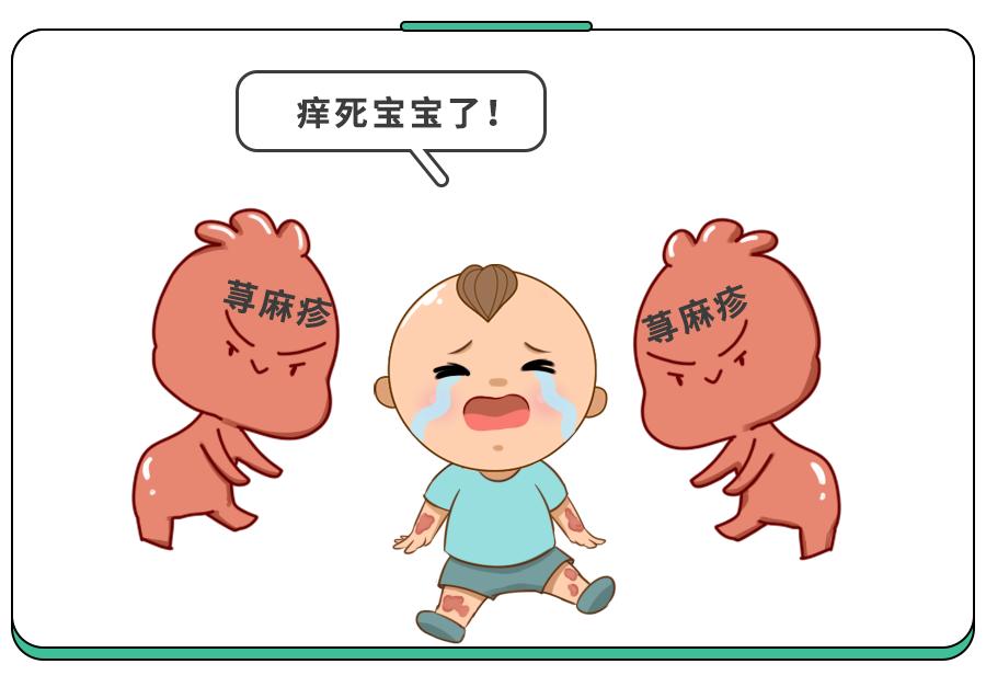 出荨麻疹痒到发狂这两样东西能救命