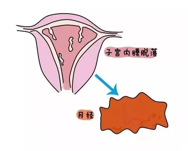 马博说 内膜那些事儿之子宫内膜增厚