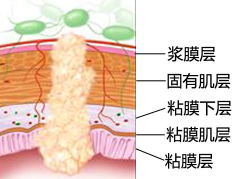 黏膜分层结构图图片