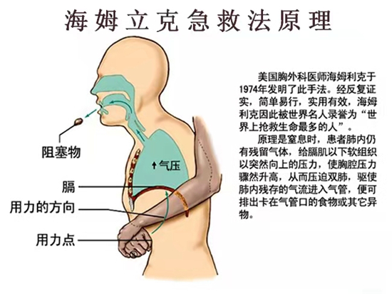 小孩噎着急救方法图解图片