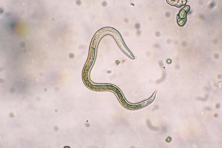 刚地弓形虫小u,最近主人怀孕了,但是我不开心!