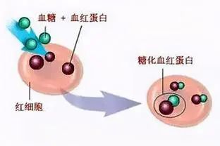 血糖糖化血紅蛋白傻傻分不清聽聽晉州市人民醫院醫生怎麼說