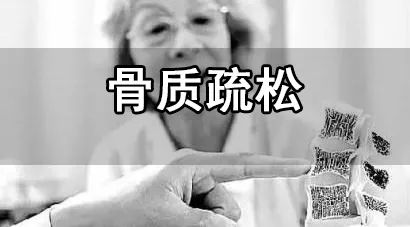 骨質疏鬆知多少骨密度檢查