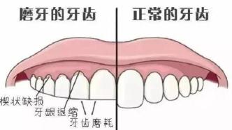 我脸变大了，是因为半夜总爱做这种事