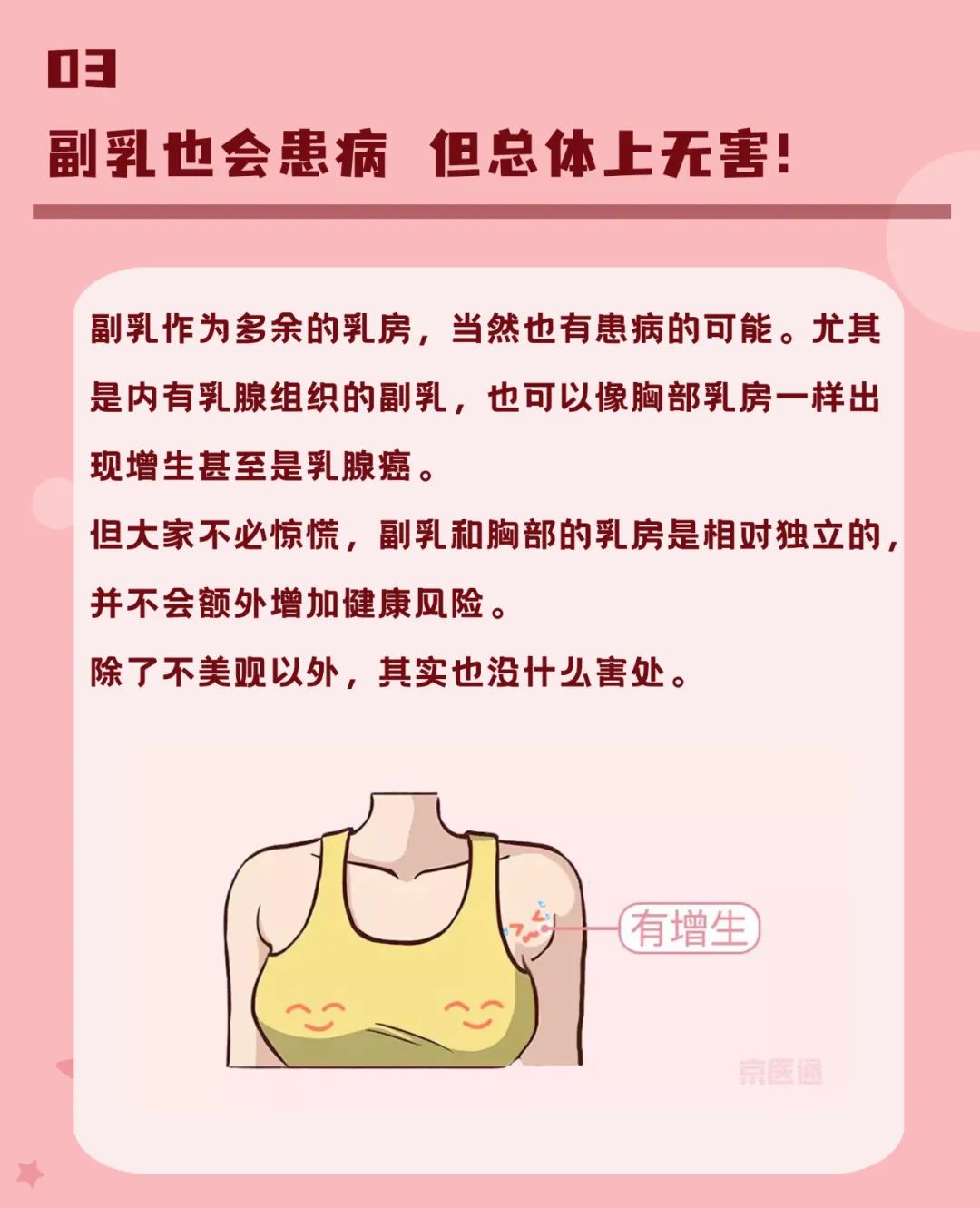 女性有副乳正常吗图片