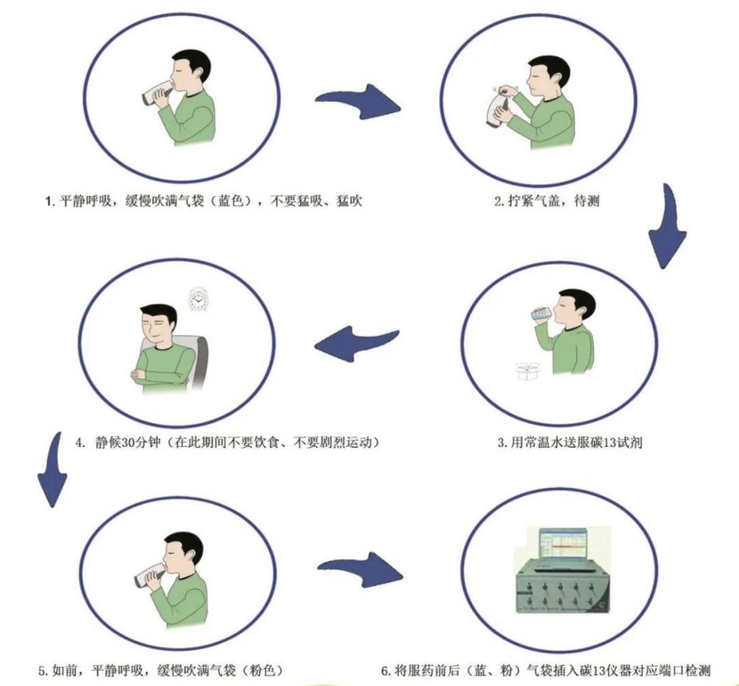 碳13或碳14尿素呼气试验:为医院最常用来检查幽门杆菌的方法,受检者把