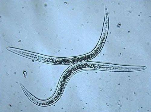 钩虫是钩口科线虫的统称,在我国主要流行十二指肠钩口线虫及美洲板口