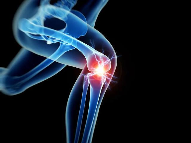 关注得了膝关节骨关节炎不要怕保膝治疗来帮您