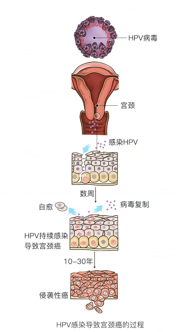 女生反复得这5种妇科病可能跟男生有关