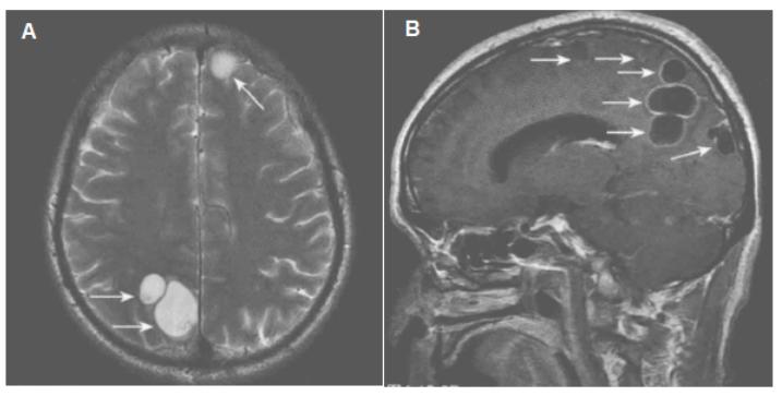 左肾结石怎么才能快速排出来 243.jpg