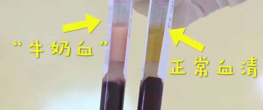 不过血液除了鲜红色和暗红色外,还会出现一些别的颜色,这些颜色能提示