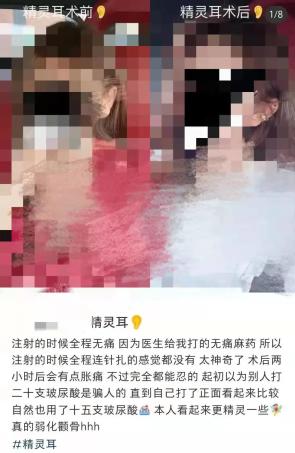 骆驼因整容被取消选美资格，外貌焦虑已经“卷”到动物身上了？