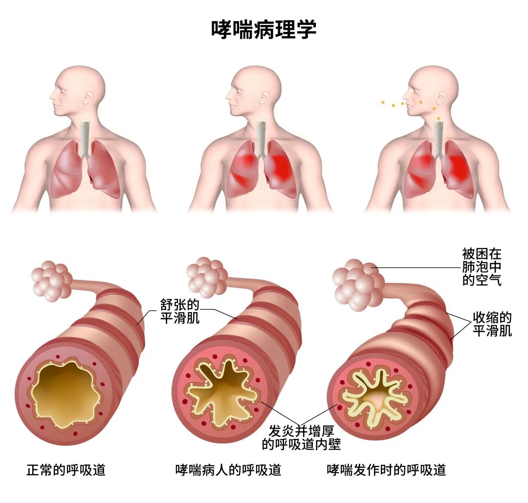 每次呼吸时,空气都会通过鼻子或嘴巴进入喉咙,最终到达肺部.