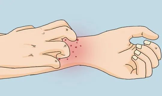 冬季皮肤瘙痒做对这几件事远离皮肤问题