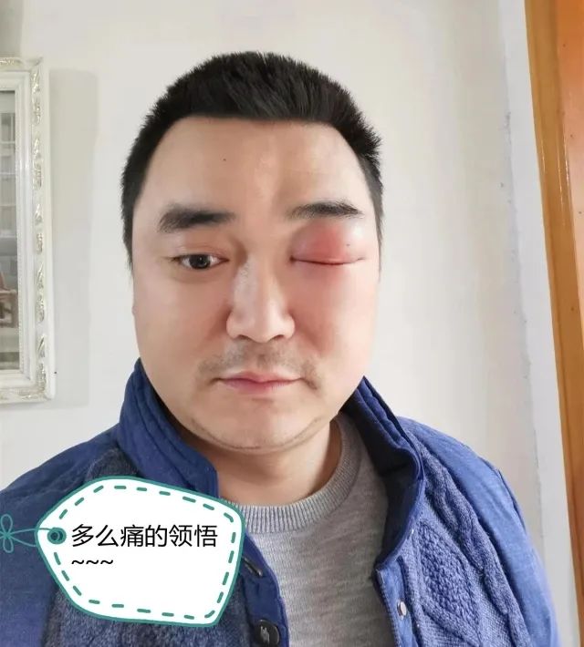 圆满完成相关验收工作依然坚守岗位被蜜蜂蜇得眼睛肿成一条缝驻村工作