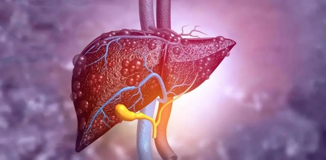 背靠背两篇science子刊论文,李红良团队破解脂肪肝炎治疗困境