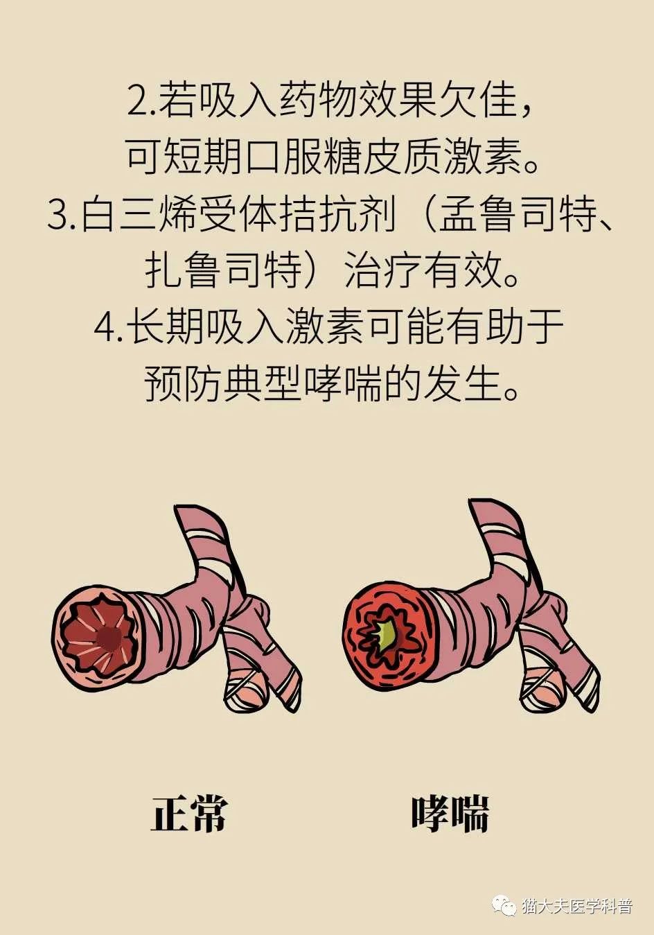 揭秘長期慢性咳嗽的真相上