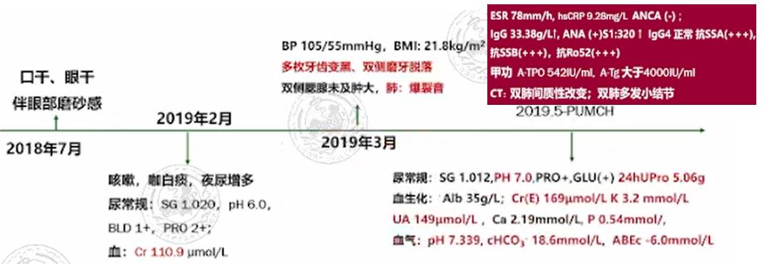 例——真实病例，现身说法59岁女性，口干、眼干1年，发现血肌酐升高2月。该病例特点为中年女性，慢性病