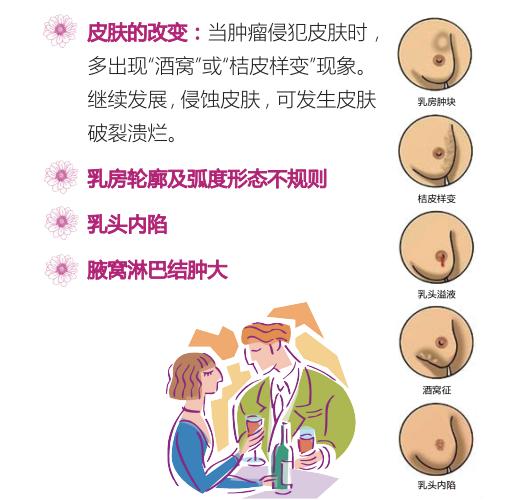 哈医大附属肿瘤医院内四科主任蔡莉,为我们科普如何健康生活,远离乳癌
