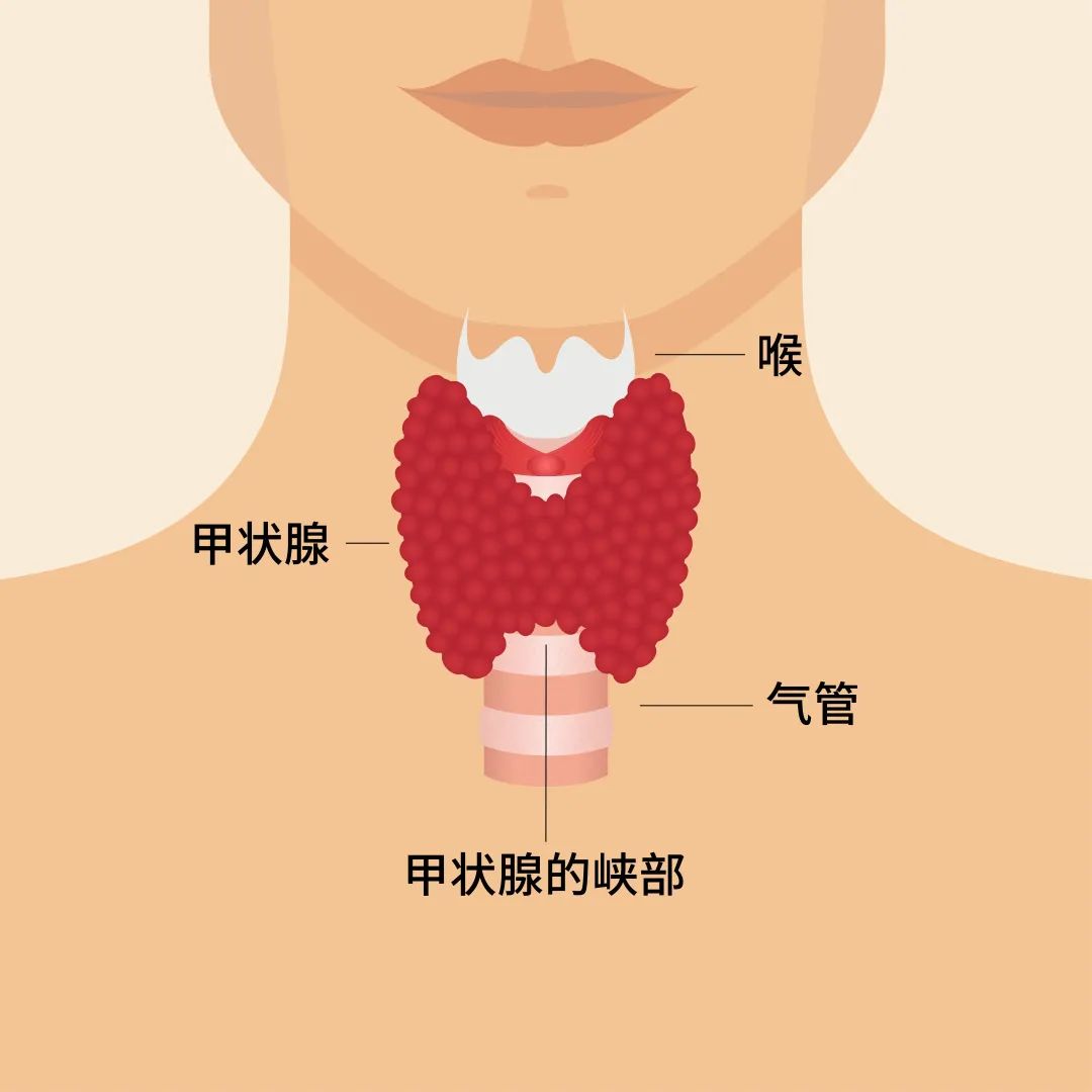 甲状腺和喉咙位置图片图片