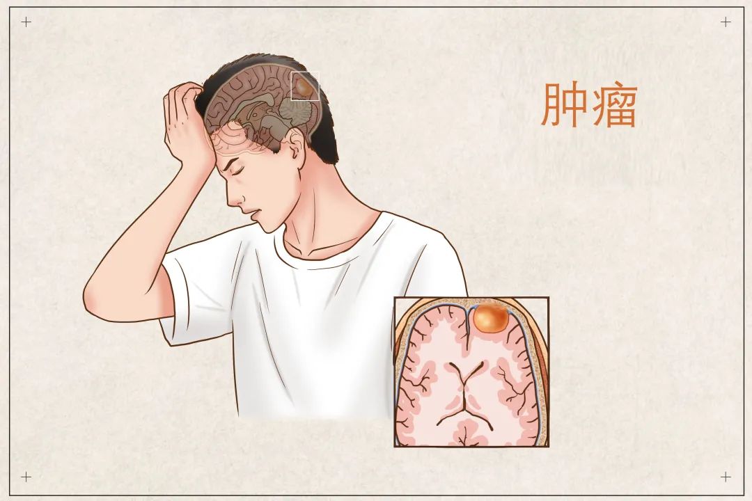 有医说医头颈部肿瘤知多少