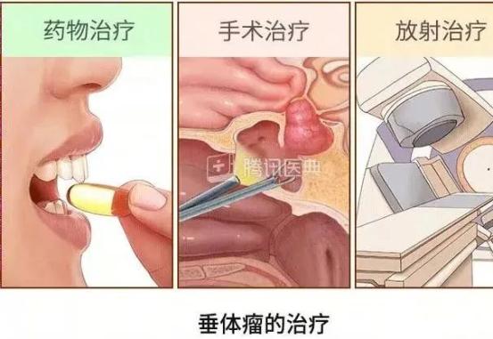 月经不调去看病，医生却说我脑袋里可能长了个瘤？