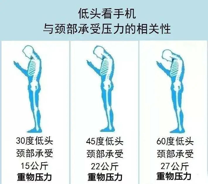 您颈椎的弧度完美吗