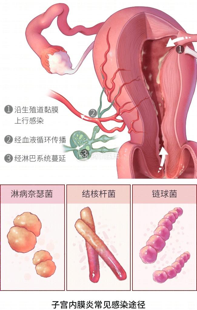 月经量少，真的会影响怀孕吗？这种情况要当心(图7)