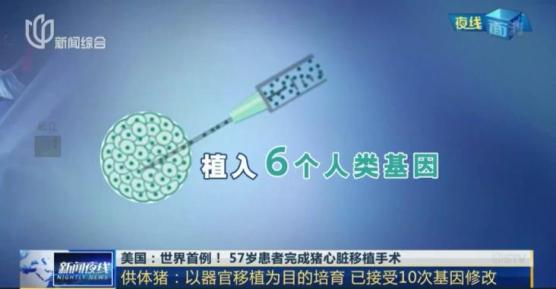 2020心脏移植_全球首例猪心脏移植人类失败原因_首例人移植猪心脏