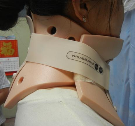 什么是费城颈托＂防低头神器＂火了！能改善脖子前倾、预防驼背？这些潜在危害一定要知道…_https://www.jmylbn.com_新闻资讯_第4张