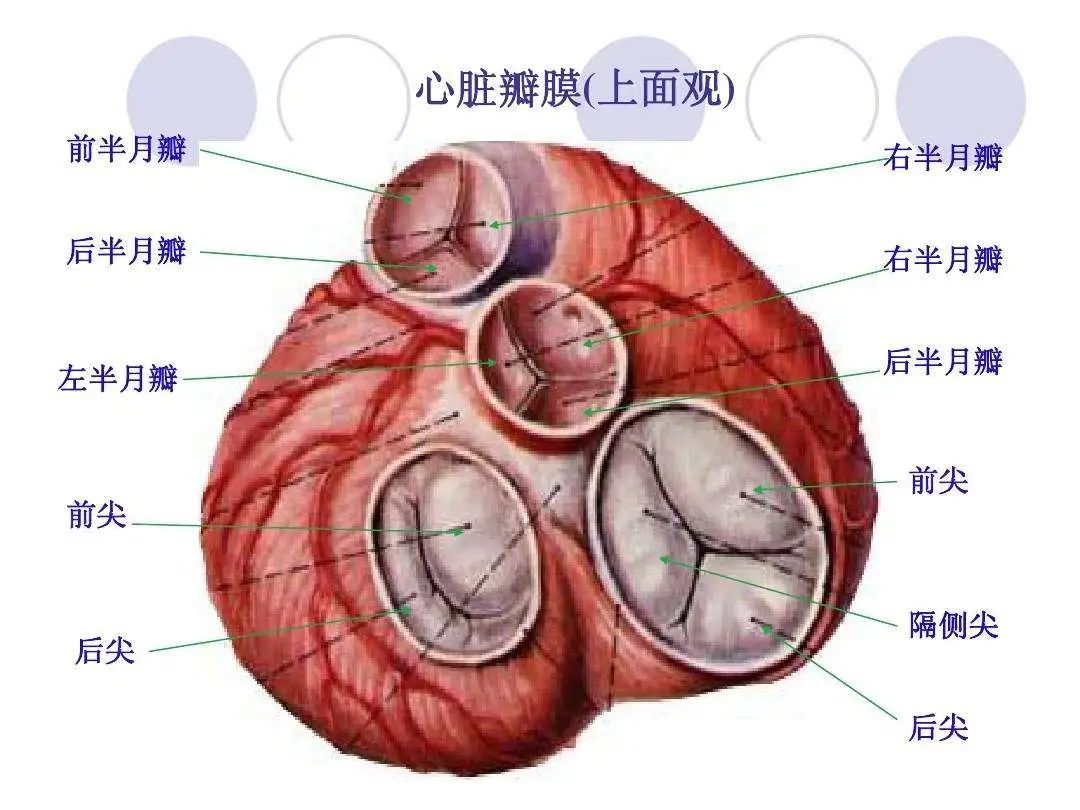 主动脉瓣左冠瓣图片