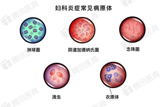 各种白带图解和病症图片