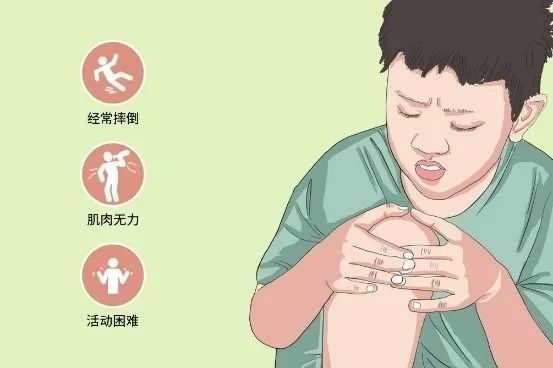 患儿多于3～4岁出现较明显临床症状,因骨盆带肌及大腿肌等无力,致使