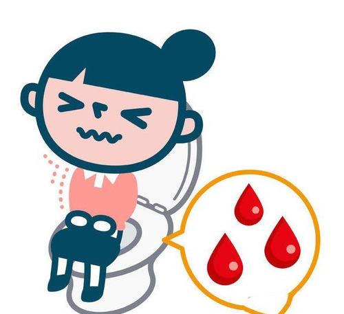 什么是软式内镜镜【浦人医·健康】健康知识月月讲之有”痔”者，是“镜”成！——痔疮的内镜治疗_https://www.jmylbn.com_新闻资讯_第1张