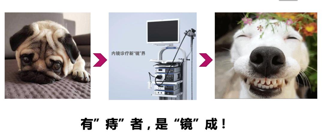 什么是软式内镜镜【浦人医·健康】健康知识月月讲之有”痔”者，是“镜”成！——痔疮的内镜治疗_https://www.jmylbn.com_新闻资讯_第15张