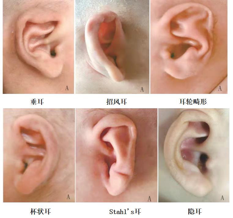 耳朵类型分类图片大全图片