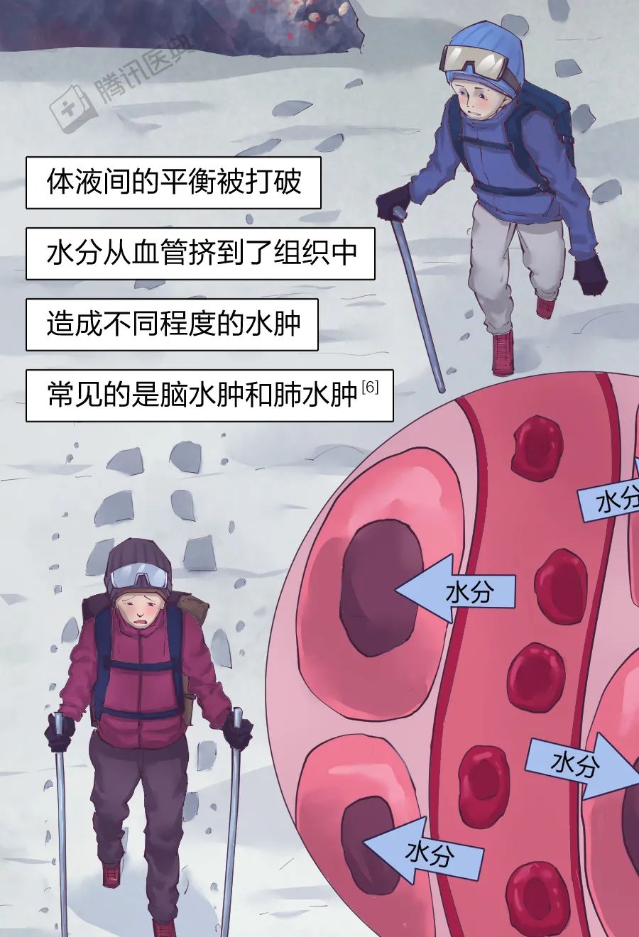 身体好的人也会有高原反应为什么高反这么可怕