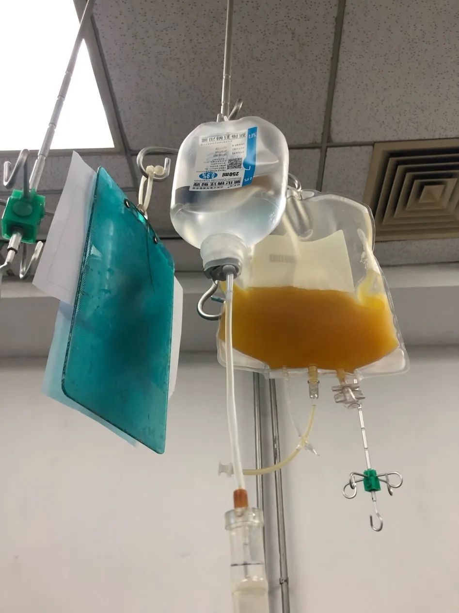 输血小板前需要查血型和血液传染病,中间要等2小时左右,我还点了个