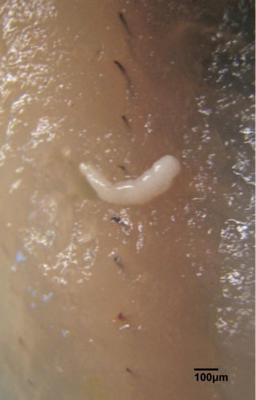 棕色米粒大小的虫卵图片