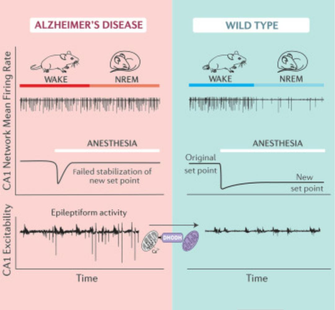 动物怎么麻醉睡眠和麻醉期间大脑活动的不稳定性是阿尔茨海默病的病理生物学基础_https://www.jmylbn.com_新闻资讯_第5张