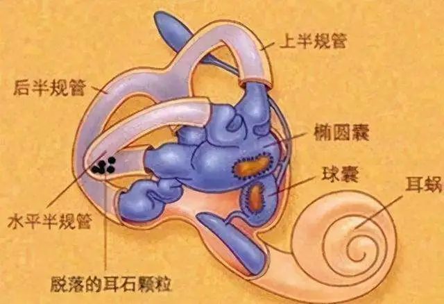 平衡运动的一组装置,名为前庭系统,由椭圆囊,球囊和三个半规管组成