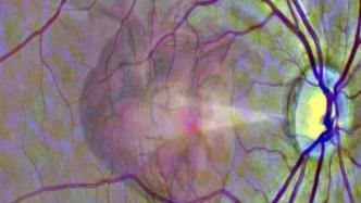 让眼睛真的成为心灵的“窗户”，AI通过视网膜筛查心脏疾病