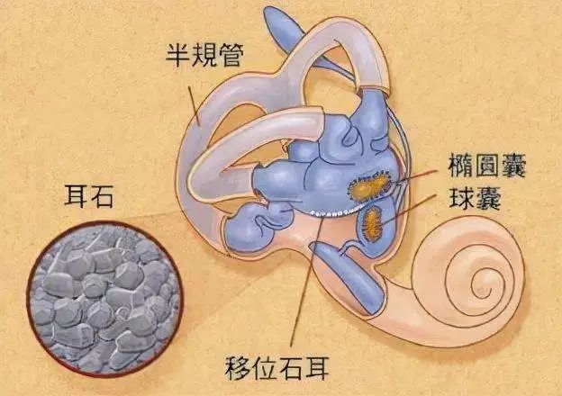 前庭器官位于我们的内耳,包括三个半规管和2个耳石器(椭圆囊,球囊).