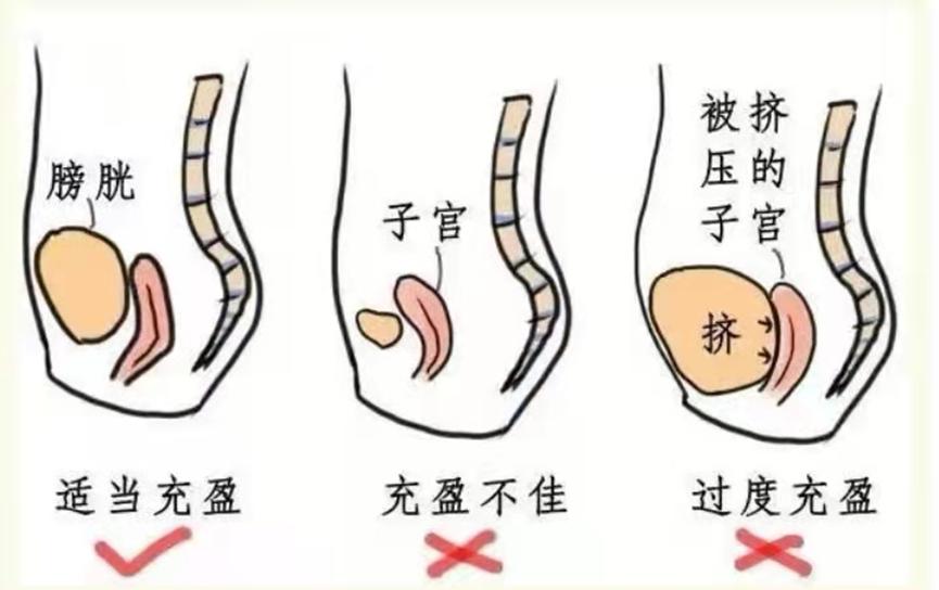 金小鸥讲健康腹超阴超肛超傻傻分不清楚