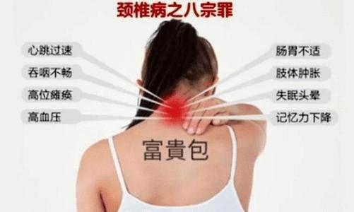 富贵包又称颈部大包,夺命包,是指位于颈胸交界处(c